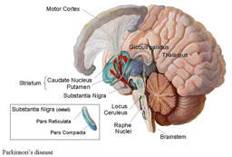 Parkinson's Disease